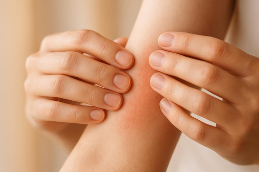 How Liver Detox Supplements May Cause Skin Reactions