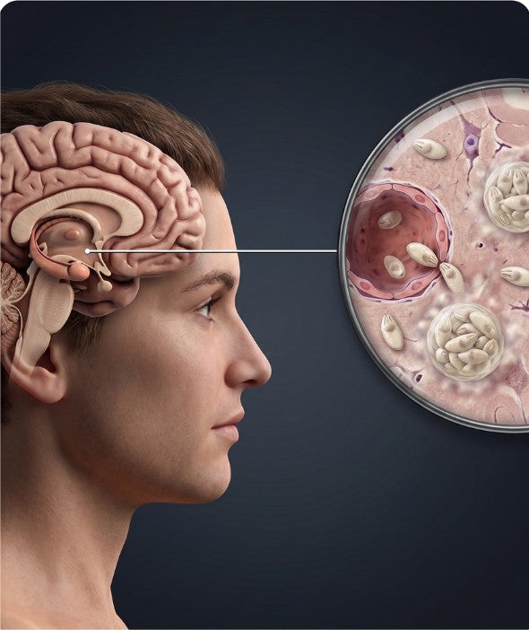 Cognitive impairment