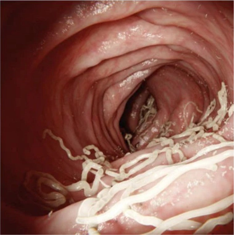 Gut microbiome