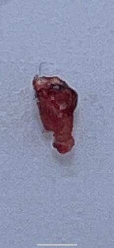Review photo